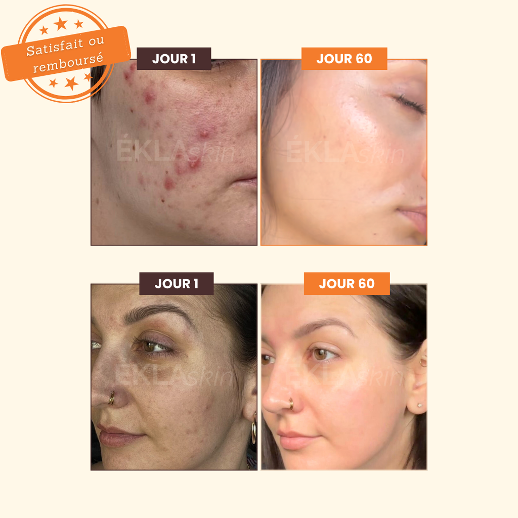 Savon Illuminateur de Teint ÉKLA