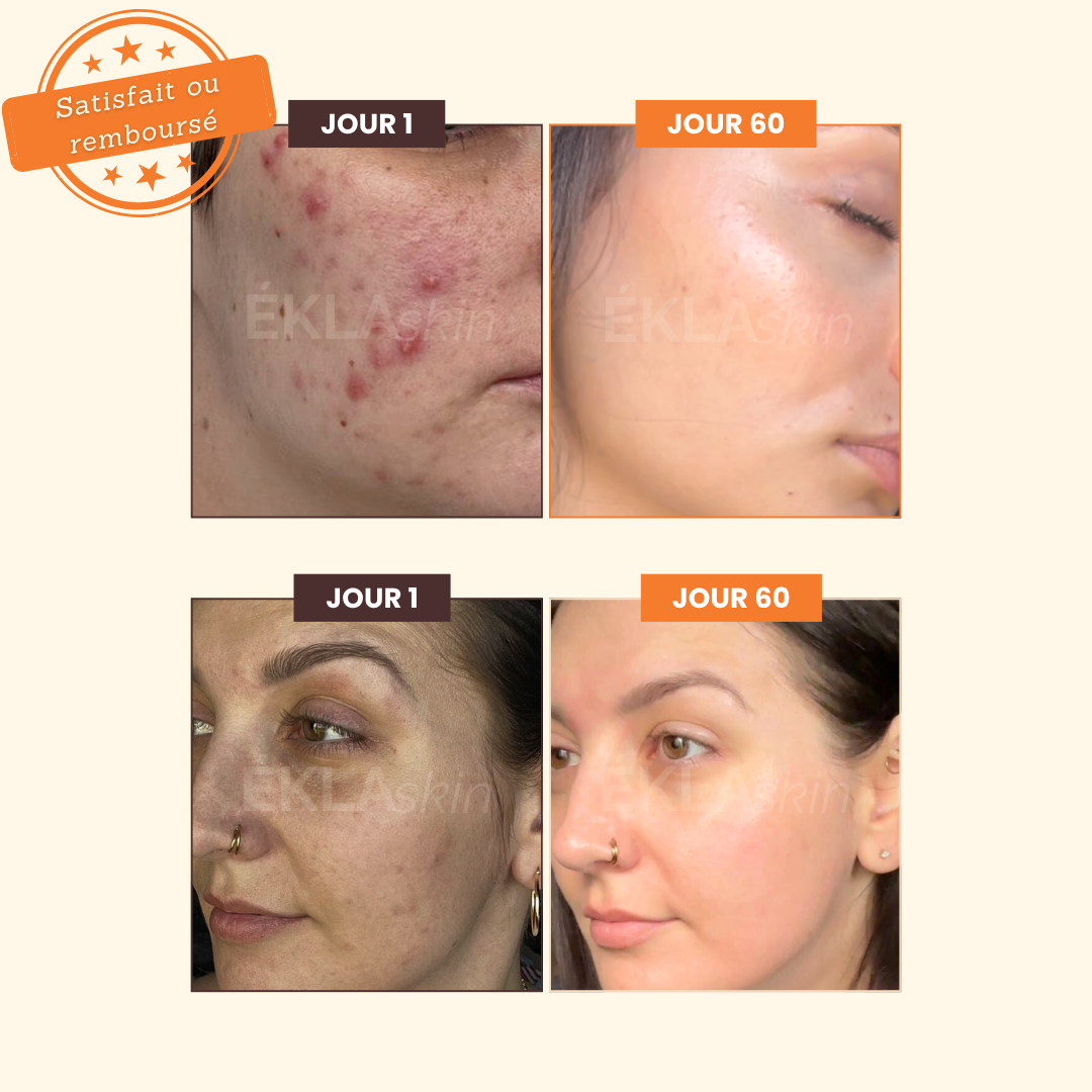 Savon Illuminateur de Teint ÉKLA